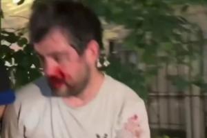 世界杯直播埃及vs伊朗在线观看_世界杯直播埃及vs伊朗免费高清直播_世界杯直播埃及vs伊朗比赛回放88